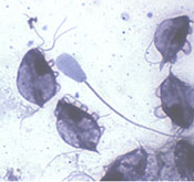 T. Foetus Protozoa
