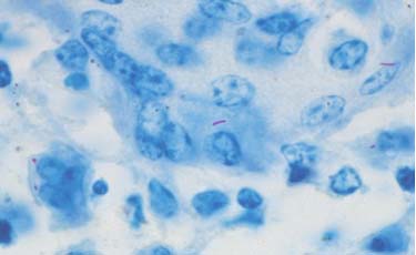 Short rec TB Bacteria