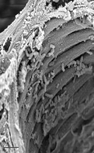 Xylem Tissue with
Xylella fastidiosa Photo by: Gordon Vrdoljak, SEM lab at UC Berkeley.