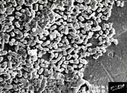 Germs magnified x100