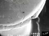 Pin head magnified 100 times