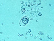 Protozoa